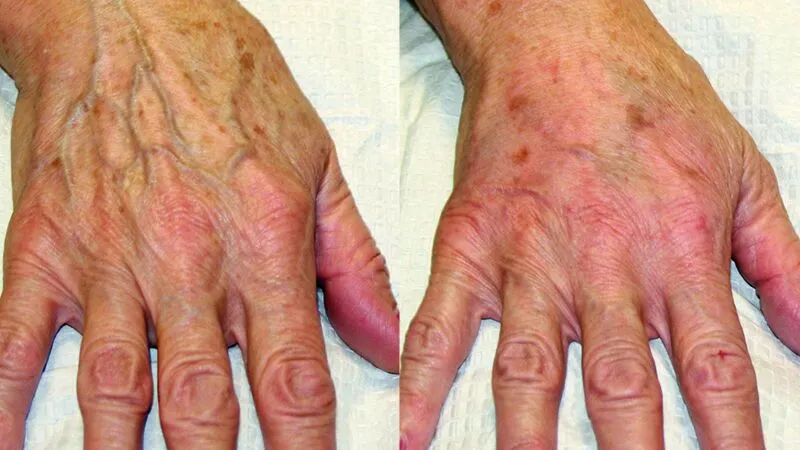 Ageing hands
